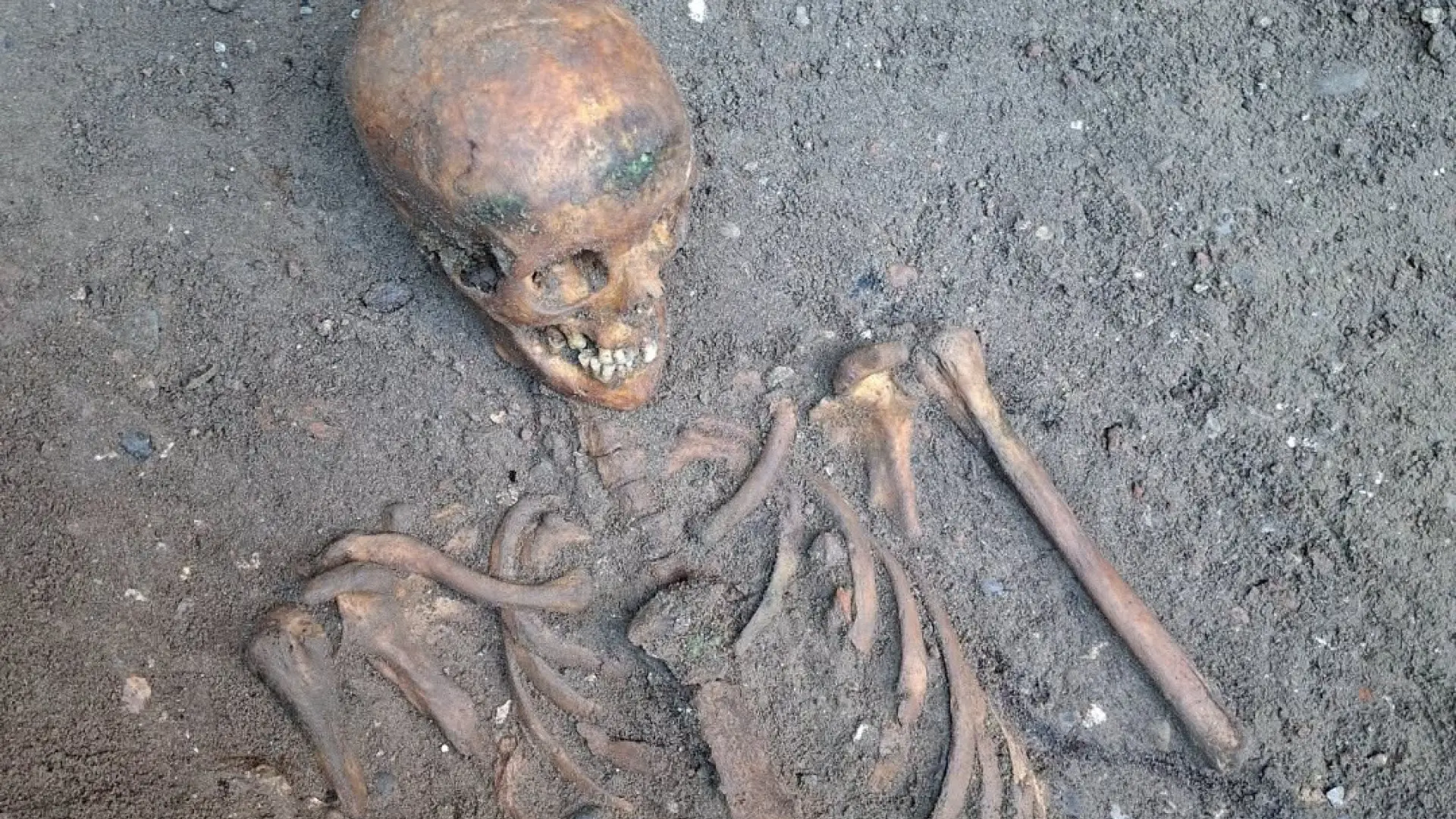 Se billederne: Arkæologer finder skeletter ved udgravning af gammel kirkegård
